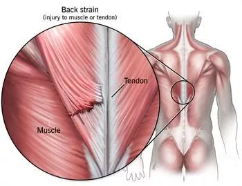 Stretches for pulled muscle in online back