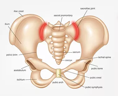 Sacroiliac Dysfunctions (Sacral Pain)  Pelvic Health Physical Therapy -  Morris County's Most Experienced Pelvic Floor Team