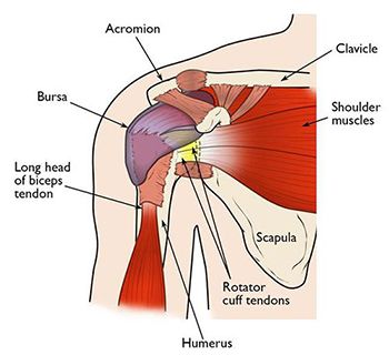 Shoulder Pain Diagnosis Chart, SPORT Orthopedics