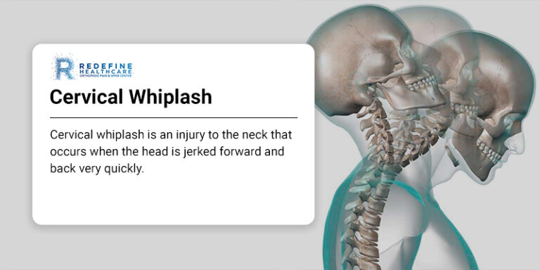 Cervical Whiplash - NJ's Top Orthopedic Spine & Pain Management Center