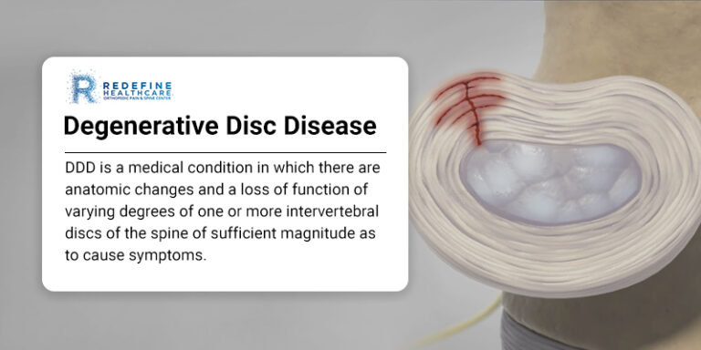 Lumbar Degenerative Disc Disease Treatment in NJ | Certified Specialists