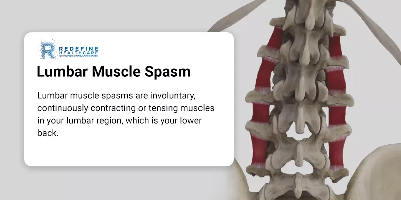 Lumbar Muscle Spasm: Symptoms, Causes, and Treatment