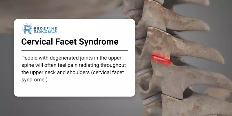 Cervical Facet Syndrome - NJ's Top Orthopedic Spine & Pain