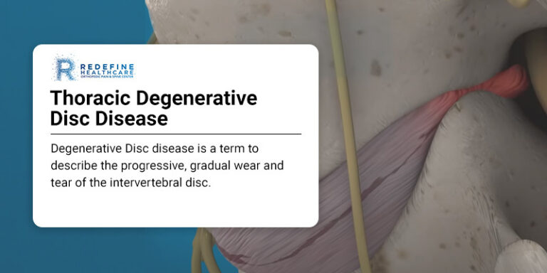 Thoracic Degenerative Disc Disease - NJ's Top Orthopedic Spine & Pain ...