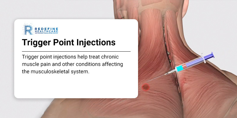 Learning About Trigger Point Injections