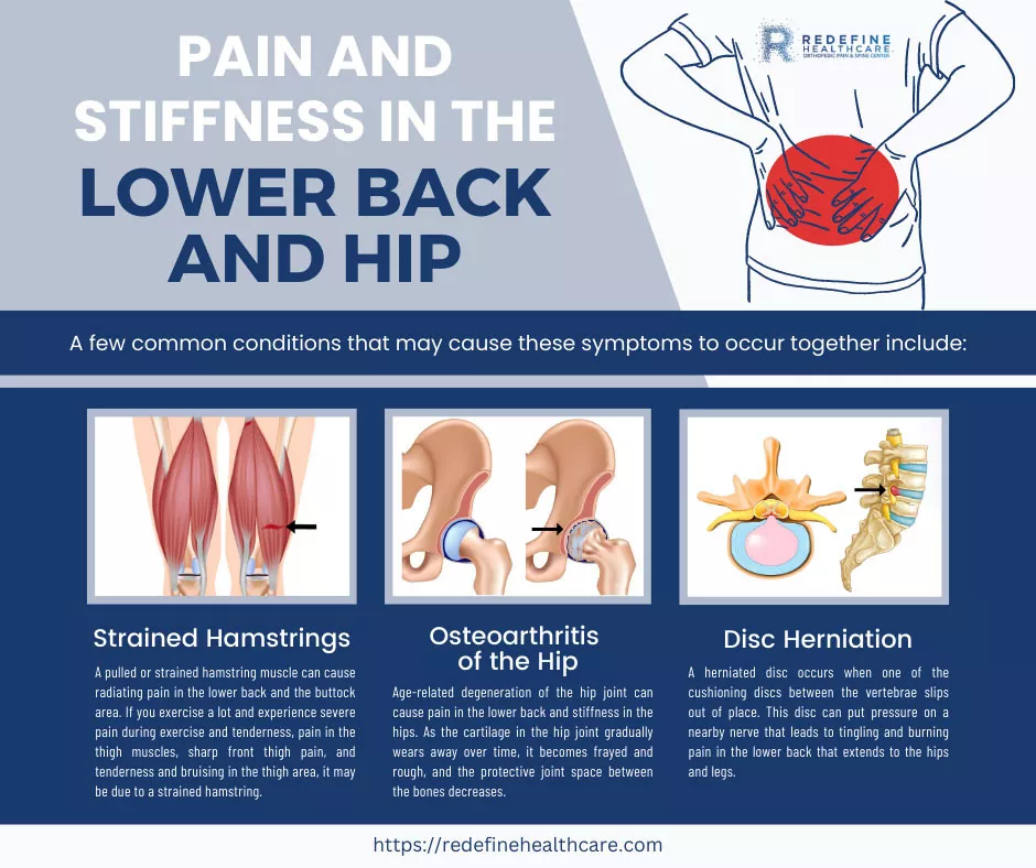 Why Does My Lower Back and Hip Hurt? - NJ's Top Orthopedic Spine