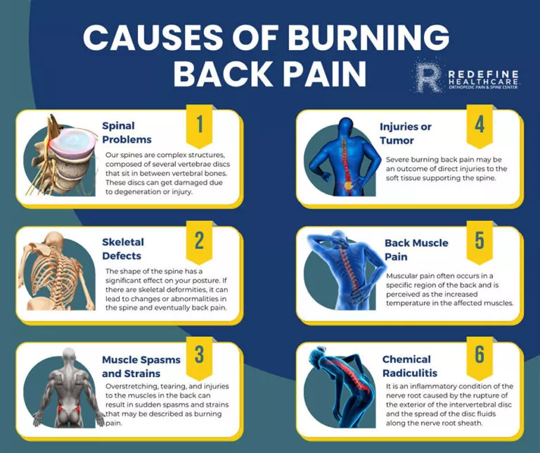 What Causes Burning Back Pain NJ S Top Orthopedic Spine Pain   What Causes Burning Back Pain Banner 768x644 