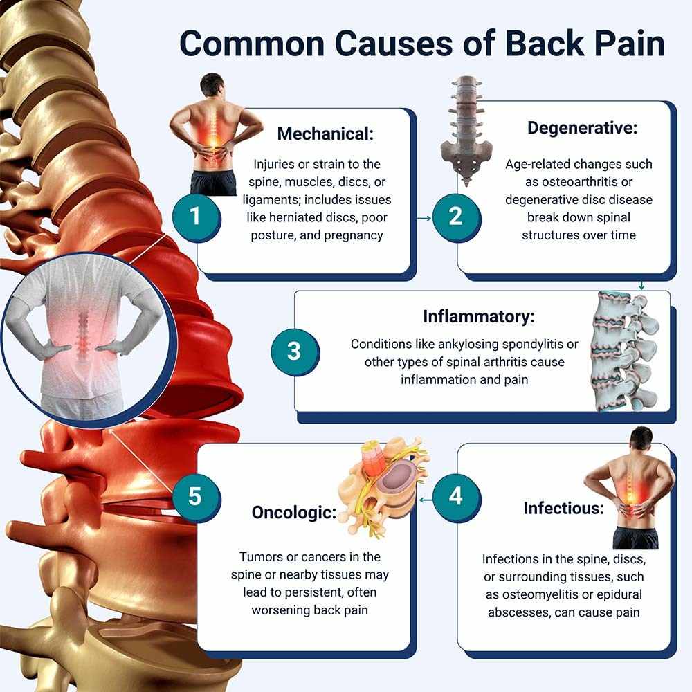 Common Causes of Back Pain in NJ