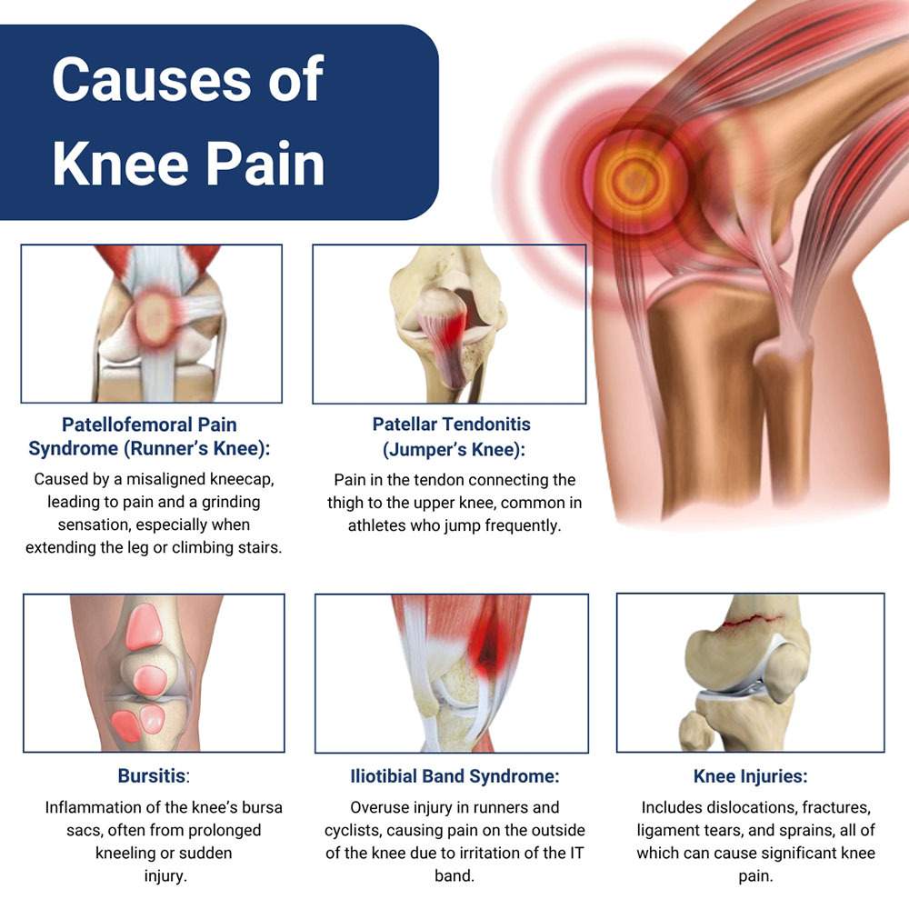 Knee Treatment in NJ - Knee Pain Doctors at Redefine Healthcare in New  Jersey, image size:1000x1000