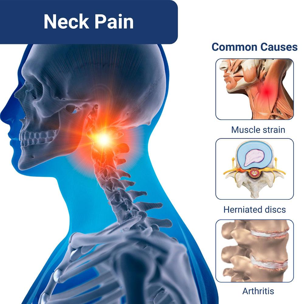 Neck Pain Causes
